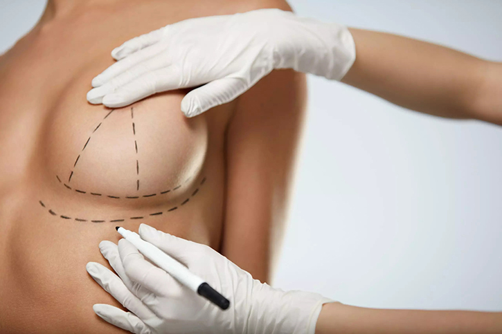 Breast Lift Surgery